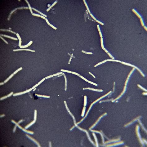 Preliminary Staining of Bacteria: Negative Stain .